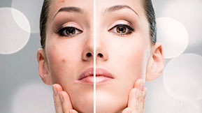 stem cell treatment for  skin rejvination